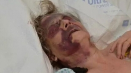 90 letnia kobieta, została ciężko pobita we własnym łóżku w Brent!