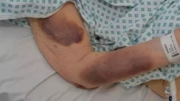 90 letnia kobieta, została ciężko pobita we własnym łóżku w Brent!